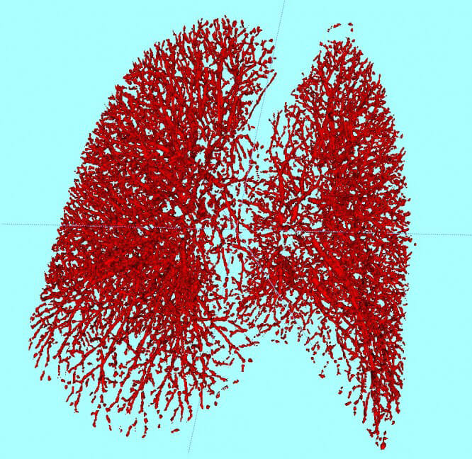 Lung vessel segmentation