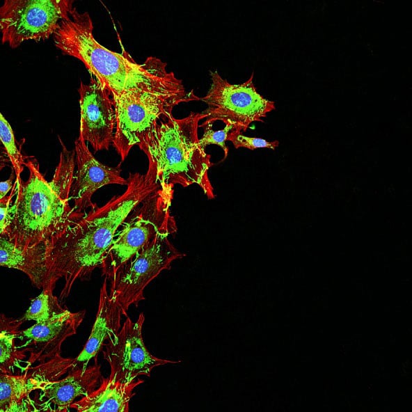 Microscopy imaging of metastatic cancer cells