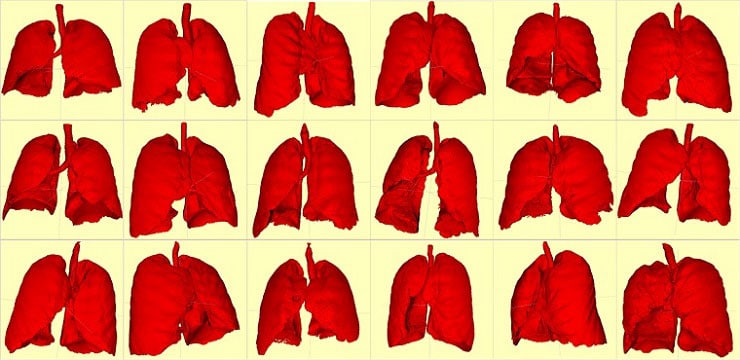 Lungs segmentation