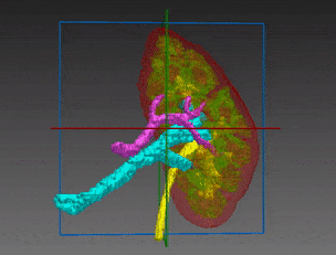 Kidney segmentation